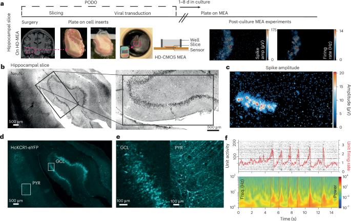 Multimodal evaluation of network activity and optogenetic interventions in human hippocampal slices