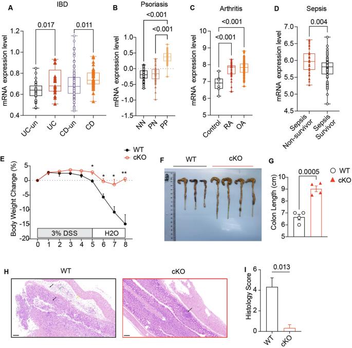 Alternative mRNA polyadenylation regulates macrophage hyperactivation via the autophagy pathway