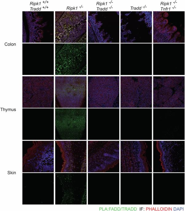 Correction to: RIPK1 prevents TRADD-driven, but TNFR1 independent, apoptosis during development