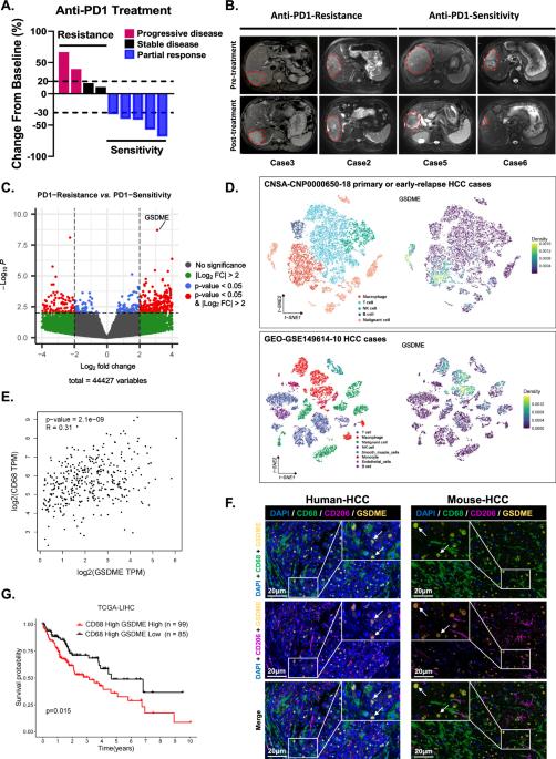 Targeting GSDME-mediated macrophage polarization for enhanced antitumor immunity in hepatocellular carcinoma