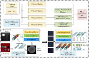 Advanced analytical methods for multi-spectral transmission imaging optimization: enhancing breast tissue heterogeneity detection and tumor screening with hybrid image processing and deep learning