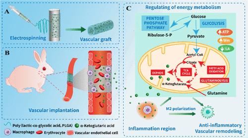 α-Ketoglutaric Acid Reprograms Macrophages by Altering Energy Metabolism to Promote the Regeneration of Small-Diameter Vascular Grafts