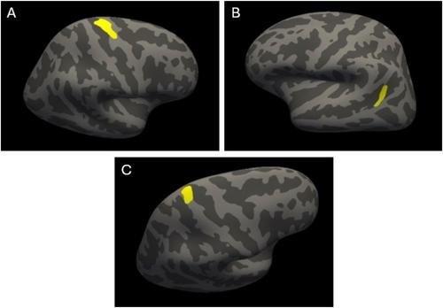 Cognitive impairment in patients with melanoma before adjuvant immune checkpoint inhibitor therapy and associations with brain gray matter, catechol-O-methyltransferase genotype, and psychological factors
