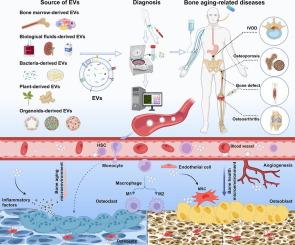 Bone aging and extracellular vesicles