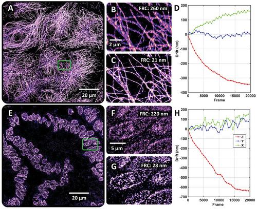 A Versatile Drift-Free Super-Resolution Imaging Method via Oblique Bright-Field Correlation