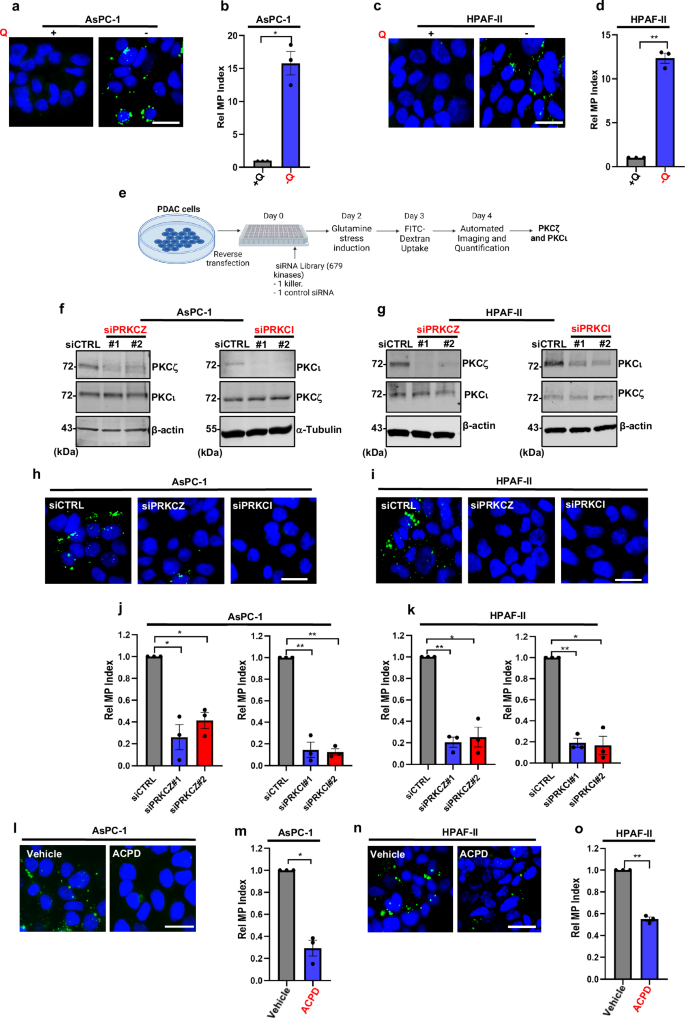 Cell polarity proteins promote macropinocytosis in response to metabolic stress