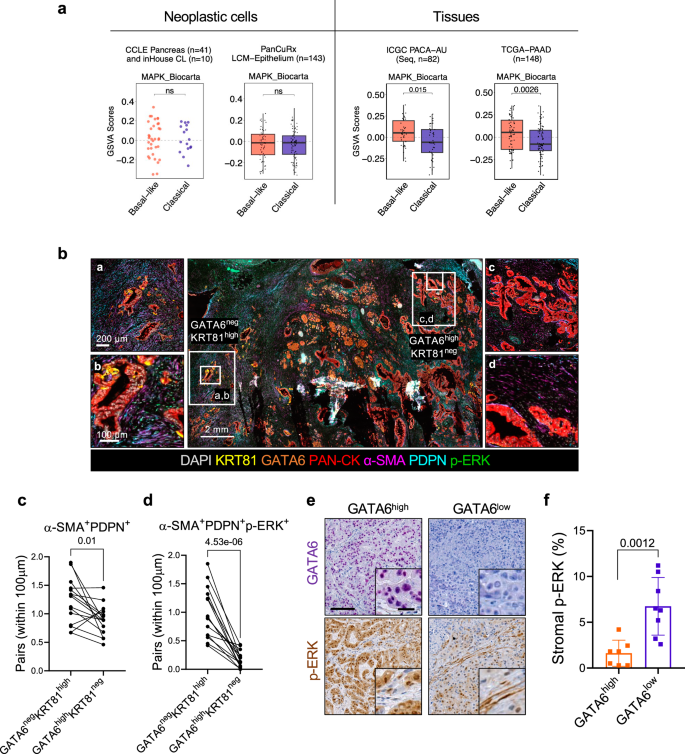 Differential activity of MAPK signalling defines fibroblast subtypes in pancreatic cancer