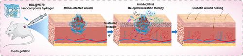 Injectable Nanocomposite Hydrogel with Synergistic Biofilm Eradication and Enhanced Re-epithelialization for Accelerated Diabetic Wound Healing