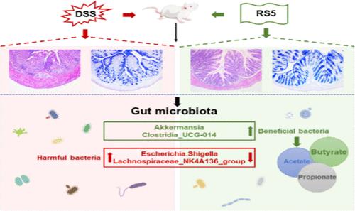 Type 5 Resistant Starch Can Effectively Alleviate Experimentally Induced Colitis in Mice by Modulating Gut Microbiota