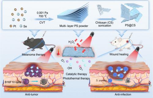 NIR-II Light-Driven Multifunctional Nanozymes PS@CS for Efficient Therapy against Melanoma and Post-tumor Surgery Infection