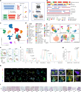 Multi-omic profiling highlights factors associated with resistance to immuno-chemotherapy in non-small-cell lung cancer