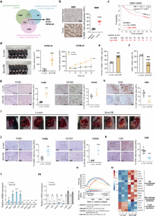 Spermine synthase engages in macrophages M2 polarization to sabotage antitumor immunity in hepatocellular carcinoma