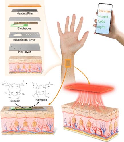 Autonomous Sweating Wearable Platform for Bilirubin Sensing Based on Thermal Stimulation