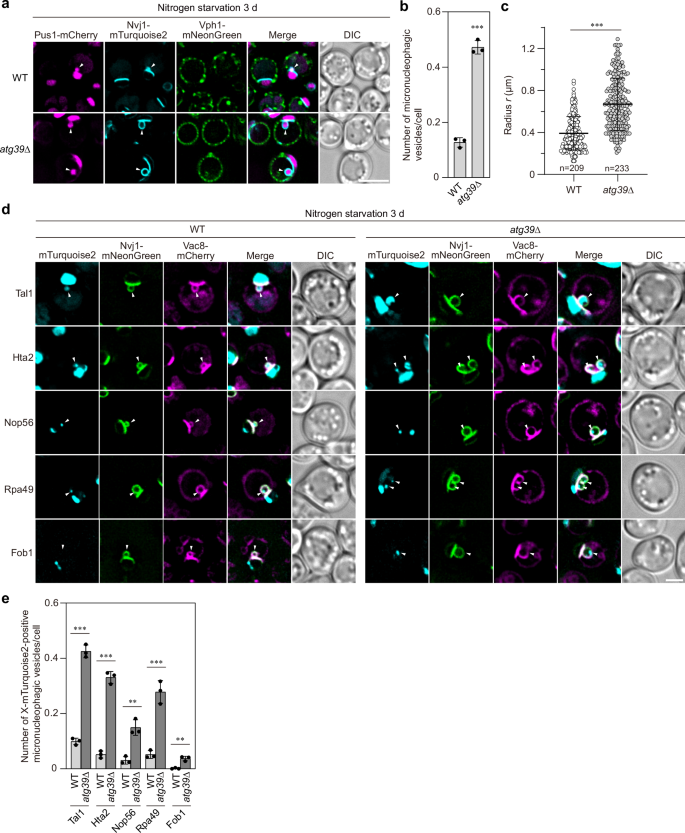 Macronucleophagy maintains cell viability under nitrogen starvation by modulating micronucleophagy