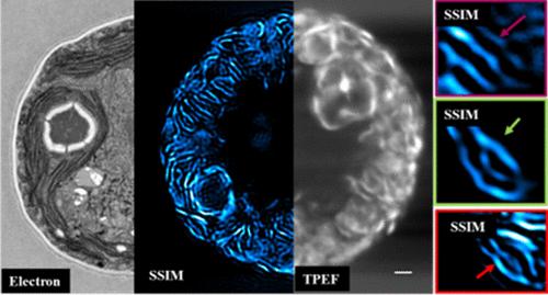 Multidimensional Characterization of the Physiological State of Hematococcuspluvialis Using Scanning Structured Illumination Super-Resolution Microscopy