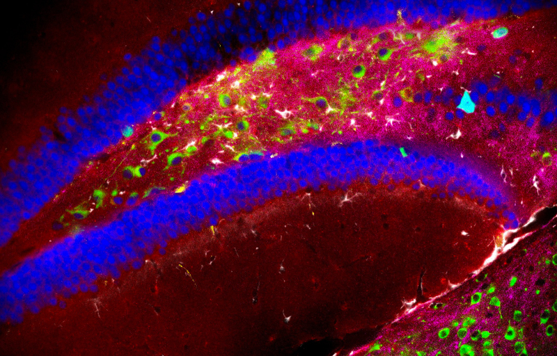 The frontiers of chemical imaging.