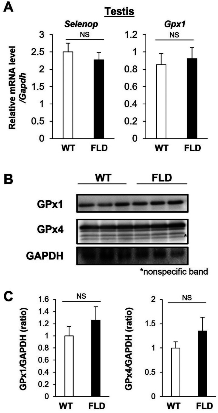 <i>Ccdc152</i> is not necessary for male fertility, but contributes to maintaining sperm morphology.