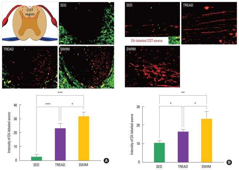 The effects of weight- and non-weight-bearing exercise on corticospinal axon sprouting, regeneration-related proteins and functional recovery after spinal cord contusion.