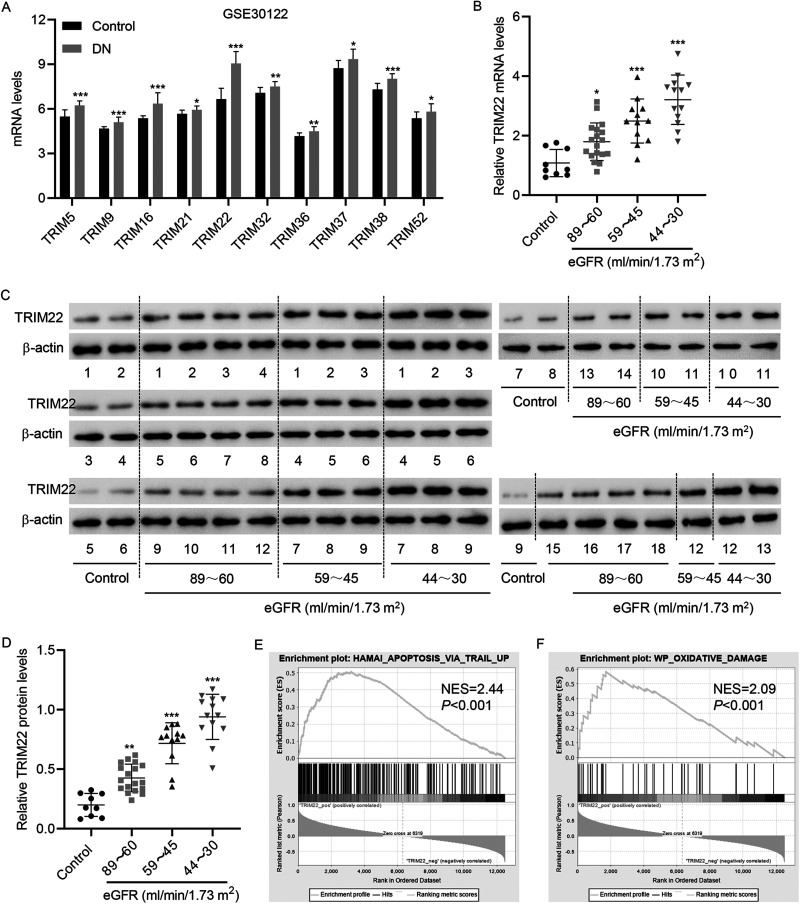 WTAP-mediated m<sup>6</sup>A modification of TRIM22 promotes diabetic nephropathy by inducing mitochondrial dysfunction via ubiquitination of OPA1.