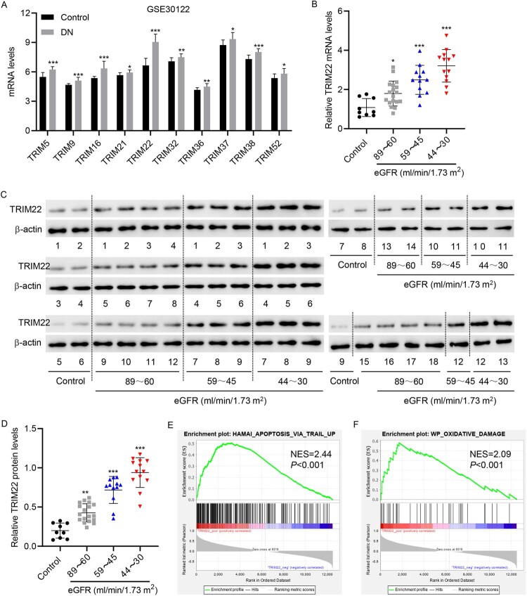 WTAP-mediated m<sup>6</sup>A modification of TRIM22 promotes diabetic nephropathy by inducing mitochondrial dysfunction via ubiquitination of OPA1.