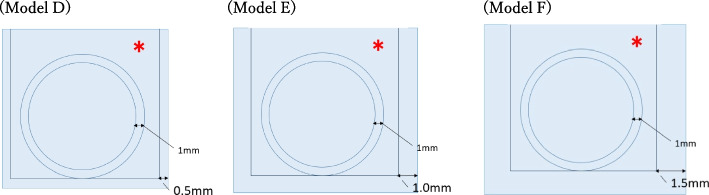 Development and evaluation of 3D-printed tumor palpation models for surgical training and patient education.