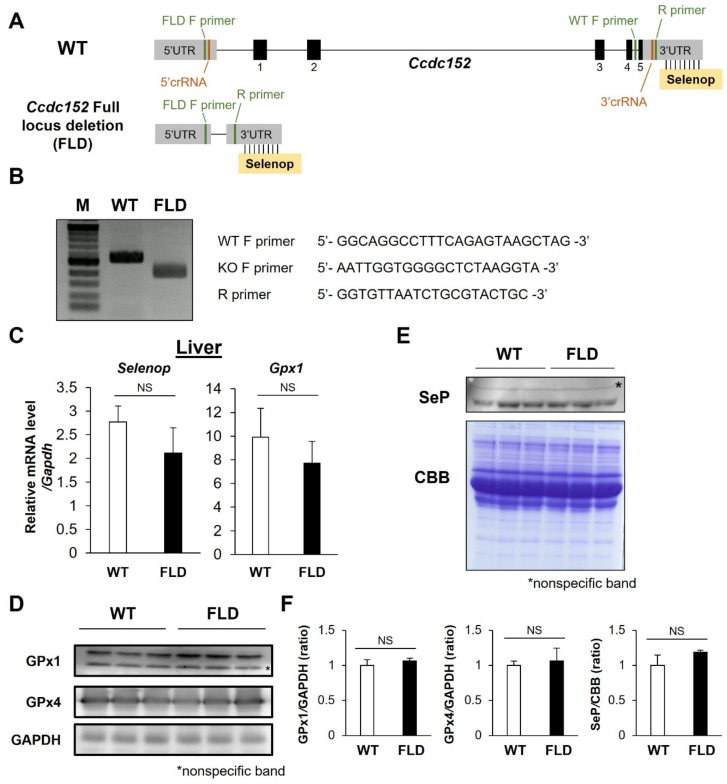 <i>Ccdc152</i> is not necessary for male fertility, but contributes to maintaining sperm morphology.