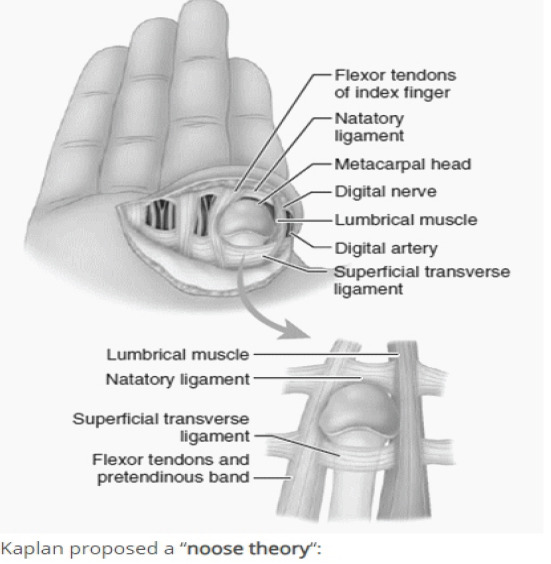 Metacarpophalangeal Joint Dislocations Two Cases, Two Stories.