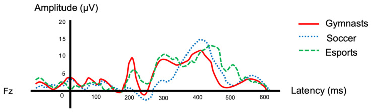 Distinct Visual Processing Patterns in Female Elite Athletes: A Comparative Study of Gymnastics, Soccer, and Esports Using Visual P300 Event-Related Potentials.