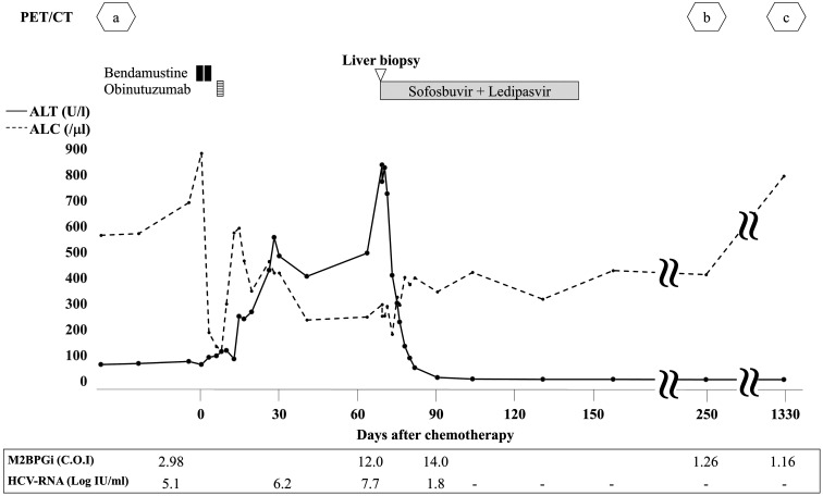 Hepatitis C virus-related hepatitis flare after immunochemotherapy in a patient with follicular lymphoma.