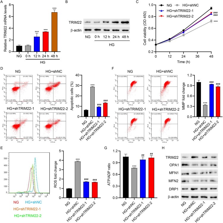 WTAP-mediated m<sup>6</sup>A modification of TRIM22 promotes diabetic nephropathy by inducing mitochondrial dysfunction via ubiquitination of OPA1.
