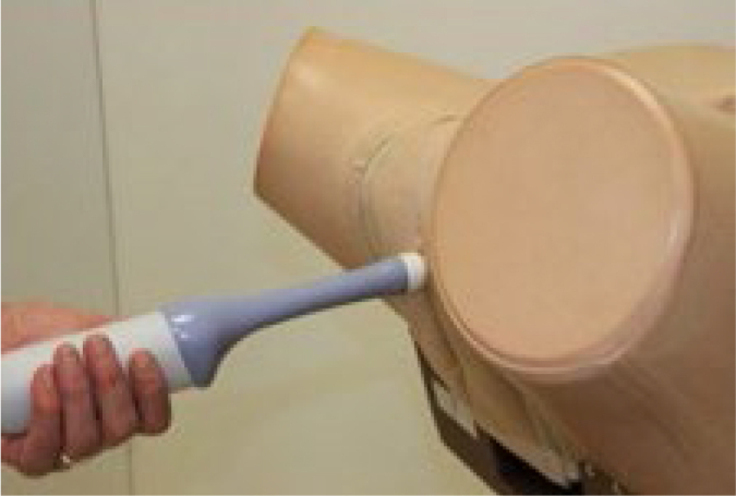 Correlation analysis of selected anatomical and functional parameters of the urethra, assessed through ultrasound and urodynamic examinations.