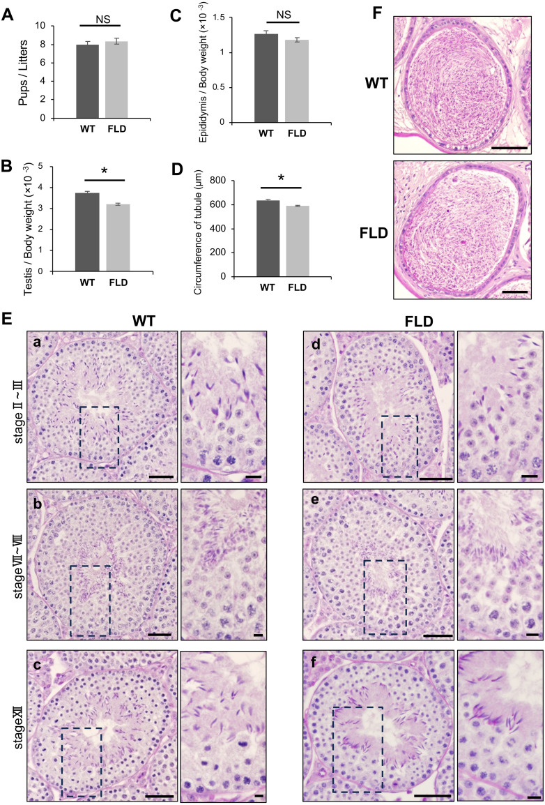 <i>Ccdc152</i> is not necessary for male fertility, but contributes to maintaining sperm morphology.