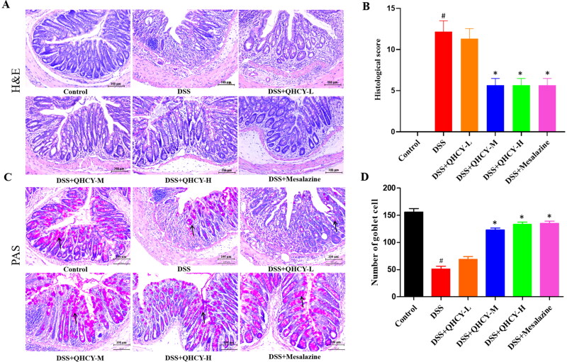 Qing Hua Chang Yin ameliorates chronic colitis in mice by inhibiting PERK-ATF4-CHOP pathway of ER stress and the NF-κB signalling pathway.