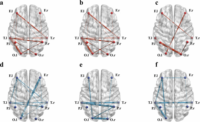 Transcranial direct current stimulation targeting the bilateral IFG alters cognitive processes during creative ideation.