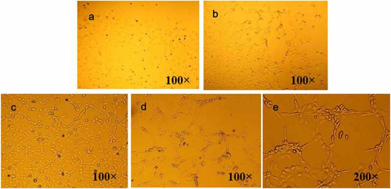 Retracted article: Mechanism of isosorbide dinitrate combined with exercise training rehabilitation to mobilize endothelial progenitor cells in patients with coronary heart disease.