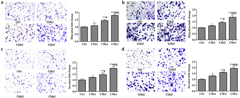 Galectin-1 overexpression induces normal fibroblasts translate into cancer-associated fibroblasts and attenuates the sensitivity of anlotinib in lung cancer.