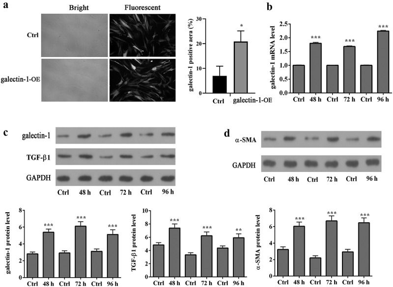 Galectin-1 overexpression induces normal fibroblasts translate into cancer-associated fibroblasts and attenuates the sensitivity of anlotinib in lung cancer.