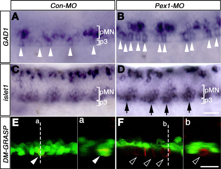 Zebrafish PEX1 Is Required for the Generation of GABAergic Neuron in p3 Domain.