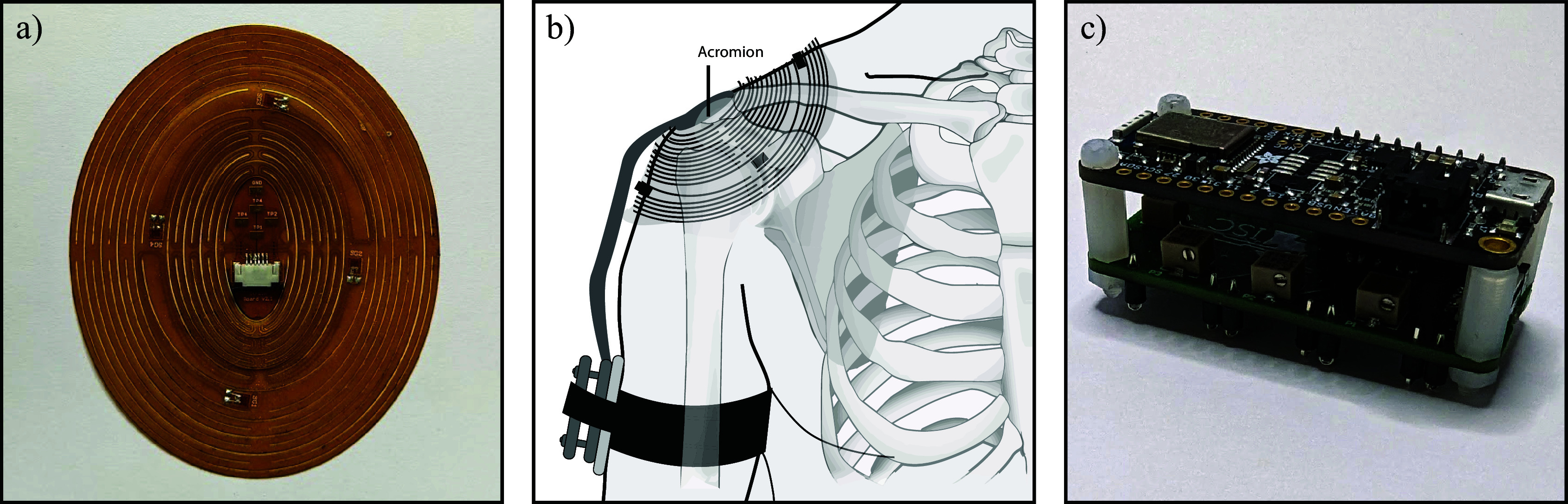 Identifying internal and external shoulder rotation using a kirigami-based shoulder patch.