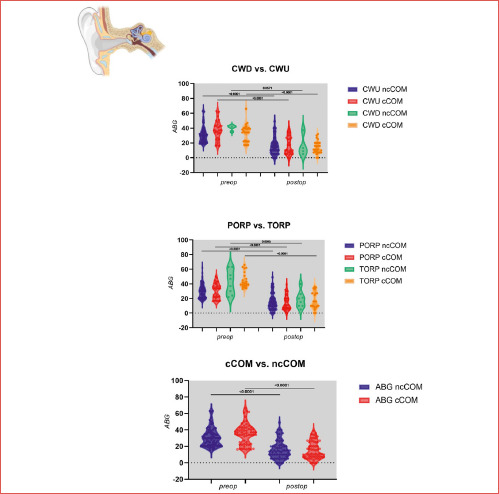 Factors influencing audiologic outcomes in ossiculoplasty for chronic otitis media: a prospective multicentre study.