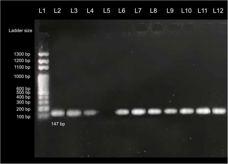 Concurrent presence of Staphylococcal Cassette Chromosome mec types of Meticillin-Resistant Staphylococcus aureus in hospital environments and post-operative patients at a hospital in Kathmandu, Nepal