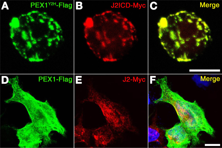 Zebrafish PEX1 Is Required for the Generation of GABAergic Neuron in p3 Domain.