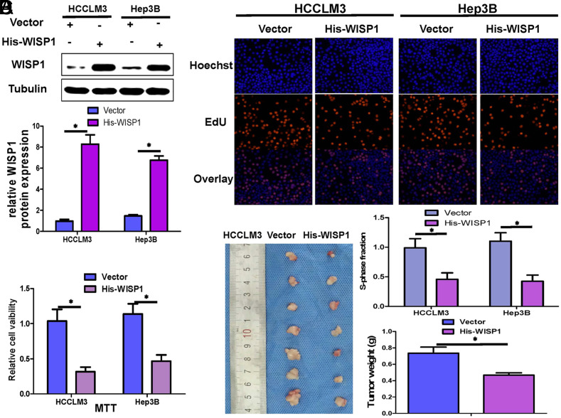 WISP1 Inhibits Hepatocellular Carcinoma Cell Proliferation by Promoting CyclinD1 Ubiquitination and Downregulating its Expression.