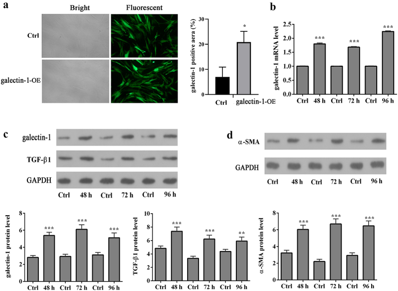 Galectin-1 overexpression induces normal fibroblasts translate into cancer-associated fibroblasts and attenuates the sensitivity of anlotinib in lung cancer.