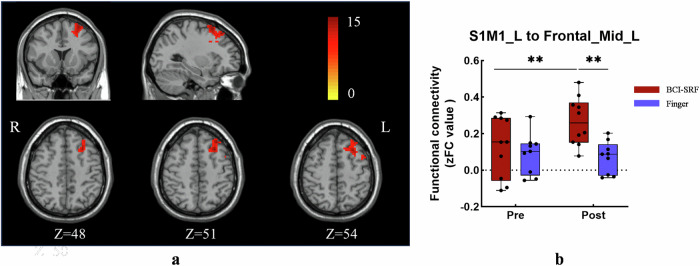 An fMRI study on the generalization of motor learning after brain actuated supernumerary robot training.