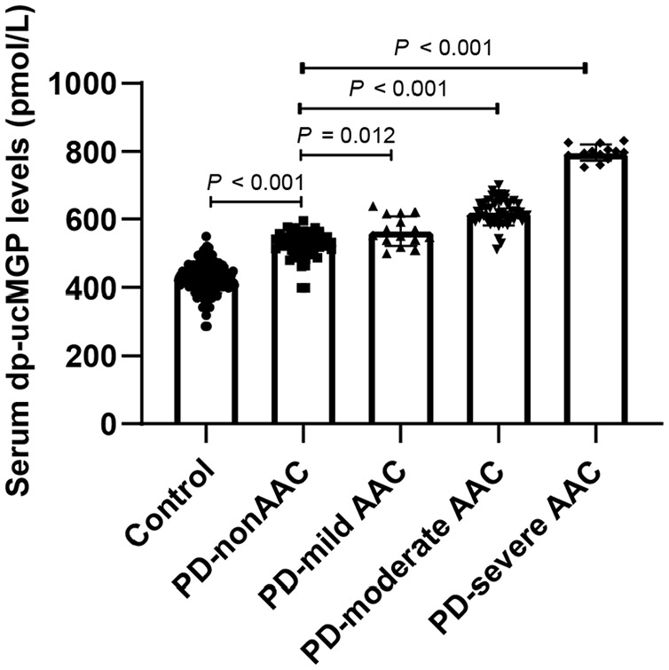 Correlation between circulating dephosphorylated uncarboxylated matrix Gla protein and vascular calcification in peritoneal dialysis patients.