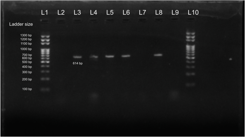 Concurrent presence of Staphylococcal Cassette Chromosome mec types of Meticillin-Resistant Staphylococcus aureus in hospital environments and post-operative patients at a hospital in Kathmandu, Nepal
