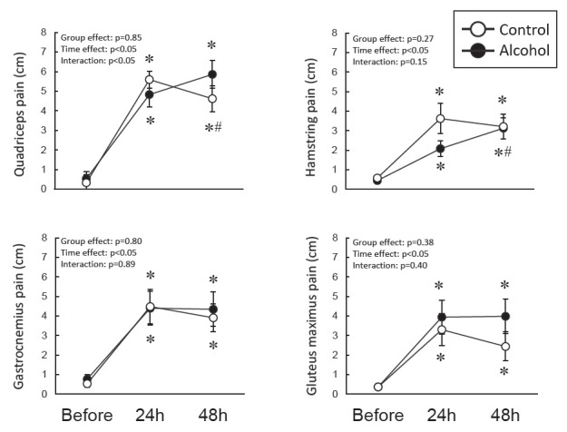 Alcohol consumption after downhill running does not affect muscle recovery but prolongs pain perception in East Asian men.