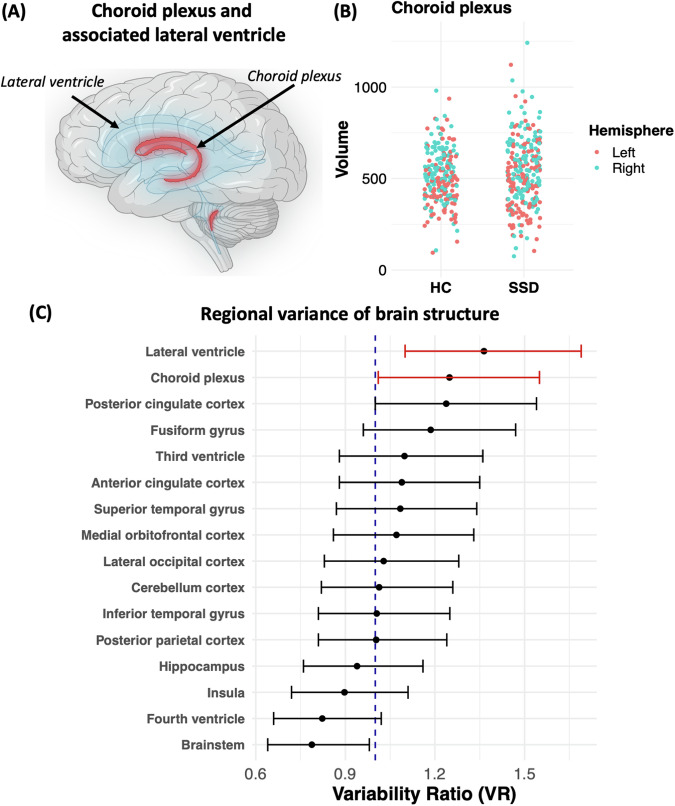 Investigation of choroid plexus variability in schizophrenia-spectrum disorders-insights from a multimodal study.