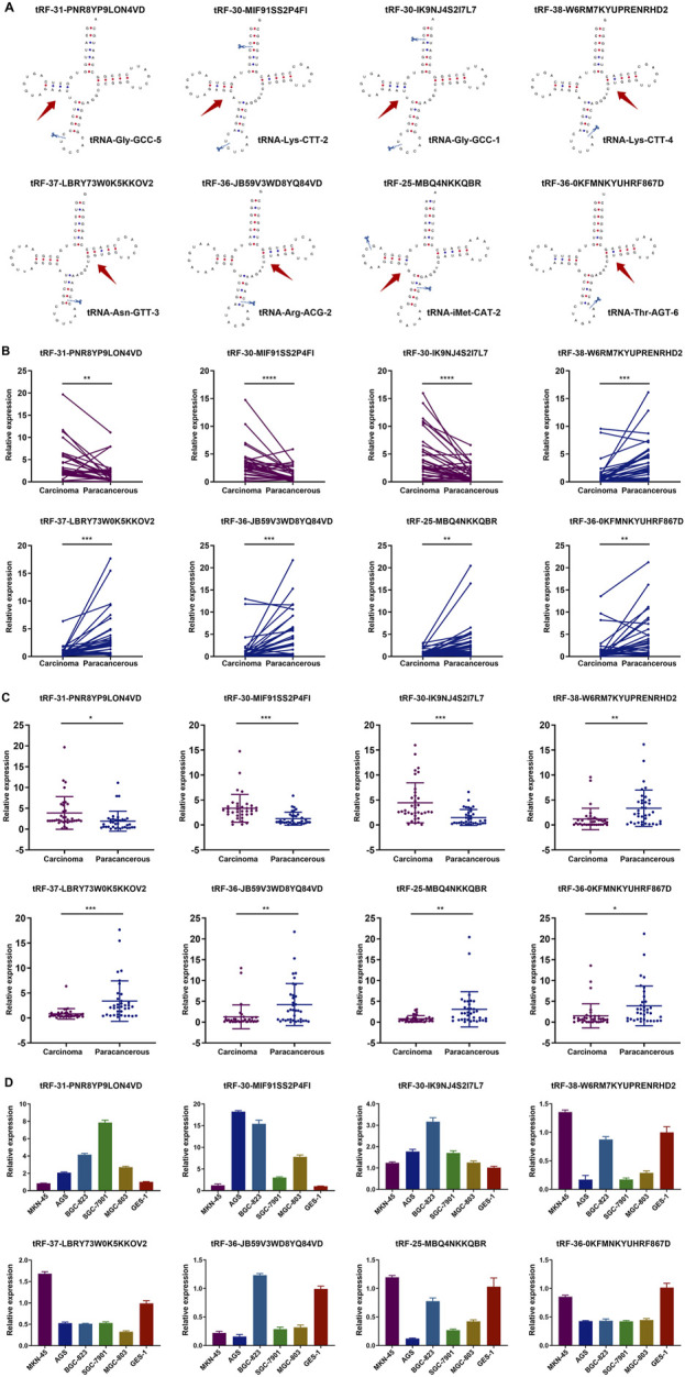 Dysregulated transfer RNA-derived small RNAs as potential gastric cancer biomarkers.